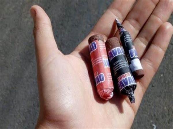 MT: Crian&ccedil;a, de 11 anos, perde dedos ap&oacute;s bombinha explodir em sua m&atilde;o enquanto brincava