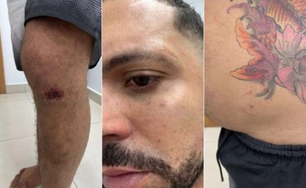 MT: Bandido, que ajudou na fuga de assassino de sargento, denuncia que foi torturado pela PM durante pris&atilde;o