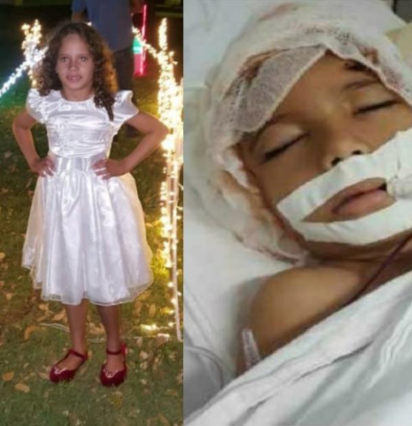 Menina de 6 anos perde couro cabeludo e orelhas após ser sugada por trator em fazenda de MT