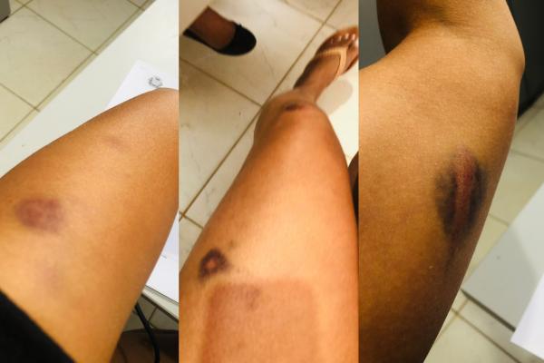 Tapurah: Mulher "torce" testículos do marido após apanhar e ser mantida em cárcere