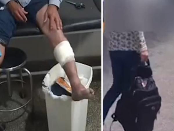 MT: Garimpeiro é baleado e tem ouro roubado após ser seduzido por "novinha" em rodoviária