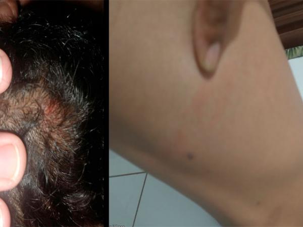 Sorriso: Homem é espancado por seguranças após usar banheiro; "eles usaram arma de choque e me deram uma cacetada na moleira"