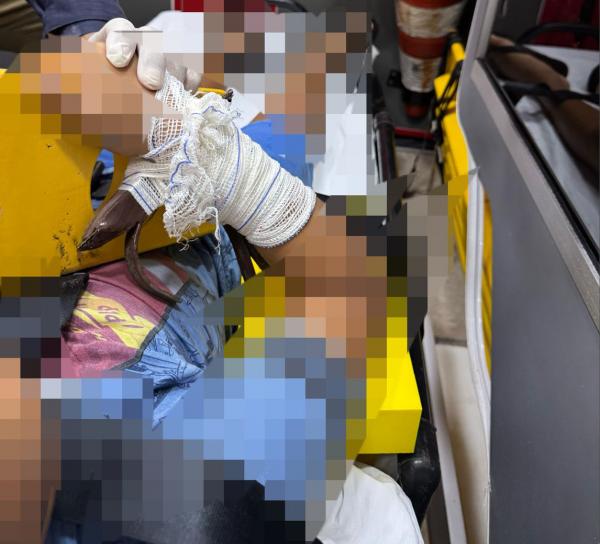 Sorriso: Criança tem mão perfurada em grade ao tentar pular muro para pegar bola no quintal do vizinho