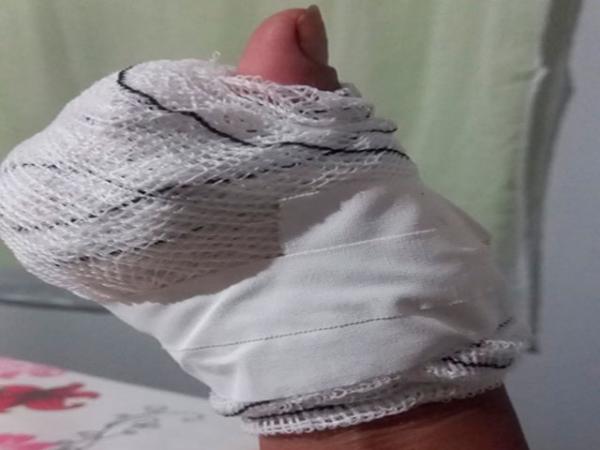 Sorriso: Mulher diz NÃO a homem que tentou beijá-la à força, é perseguida, agredida e tem mão cortada