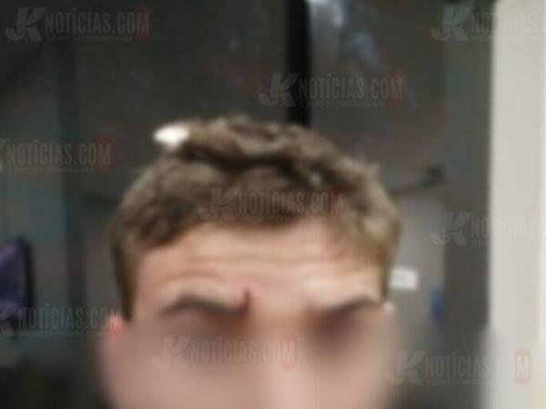 Sorriso: Jovem é espancado na frente de casa após pai se envolver em acidente e fugir; "eu não tinha nada a ver"
