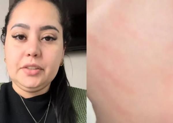 "Marcou a pele do meu anjo": mãe encontra marca de palmada na filha ao retornar de creche