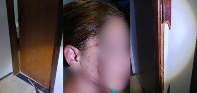 Tapurah: Mulher &eacute; espancada e tem nariz quebrado pelo marido ap&oacute;s perguntar sobre amante