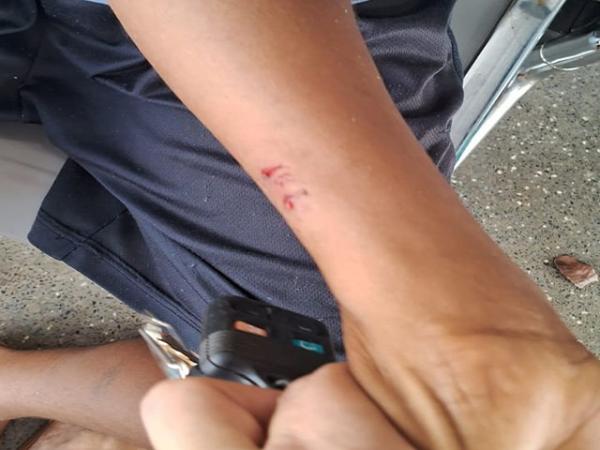 Trivelato: Cachorro solto ataca adolescente e provoca ferimentos