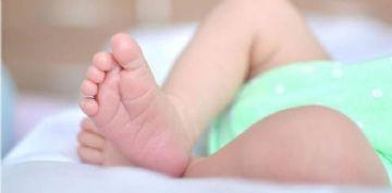 Recém-nascida tem rosto queimado por ferro quente; pai é preso