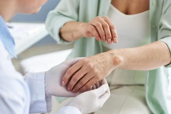 Quatro crian&ccedil;as s&atilde;o diagnosticadas com suspeita de hansen&iacute;ase em Chapada dos Guimar&atilde;es (MT)