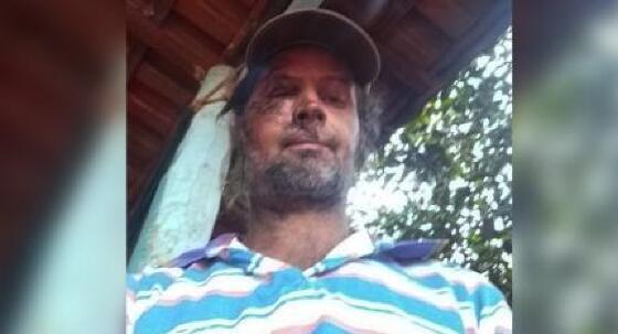 Ciclista que foi atropelado duas vezes diz que não viu nada e foi salvo por Deus