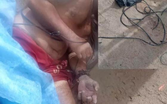 Sorriso: Homem dá entrada no HRS após ser torturado e baleado no rosto