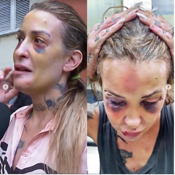 Jornalista &eacute; agredida com soco ingl&ecirc;s e torturada pelo namorado