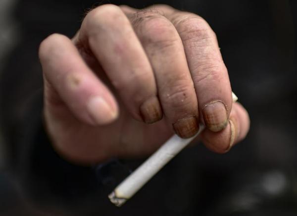 Sorriso: Mulher decide, depois de apanhar v&aacute;rias vezes, denunciar marido ap&oacute;s ser espancada e ter rosto queimado com cigarro