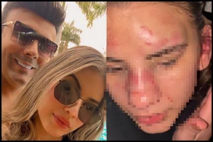 MT: Esposa chora e diz estar indignada com pris&atilde;o de apresentador suspeito de agredi-la