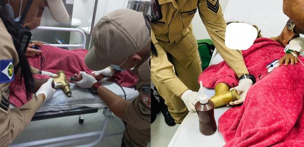 Sorriso: Menina, de 4 anos, teve dedos amputados ap&oacute;s prender a m&atilde;o em cilindro