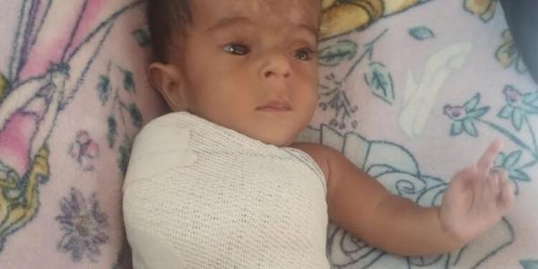 MT: Beb&ecirc; de 9 meses diagnosticado com ossos de vidro sofreu seis fraturas desde que nasceu