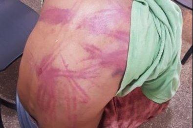 Sinop: Ap&oacute;s levar "salve" de fac&ccedil;&atilde;o, homem &eacute; socorrido em estado grave