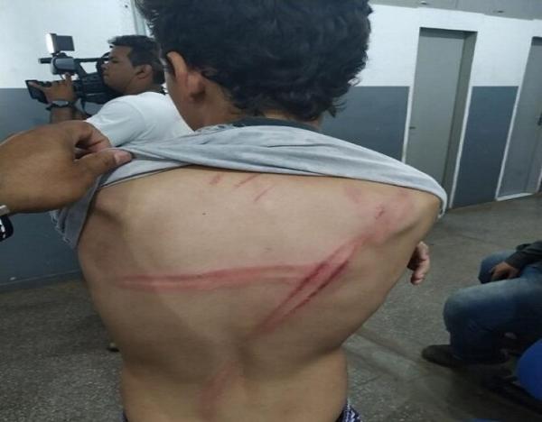 MT: Padrasto &eacute; preso ap&oacute;s torturar enteado de 11 anos por n&atilde;o querer beijar menina