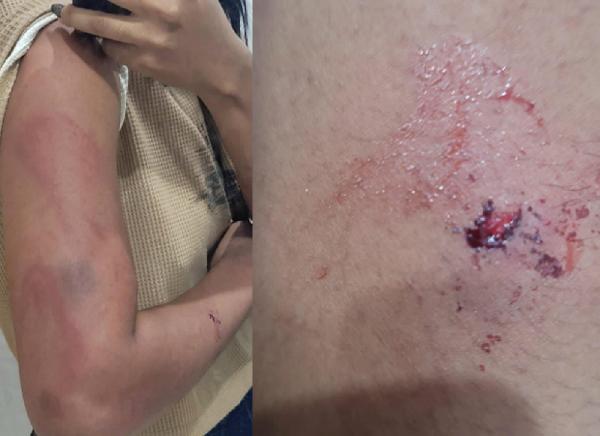 MT: Pai &eacute; preso ap&oacute;s dar cintadas na filha adulta ao discordar da cria&ccedil;&atilde;o dada ao neto