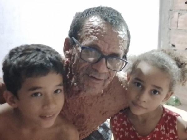 Sorriso: Com doen&ccedil;a rara e pai solo de 4 filhos, homem pede ajuda para tratar doen&ccedil;a