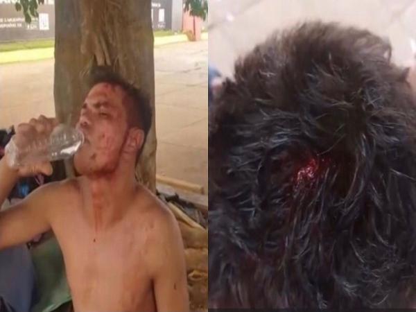 Sorriso: Andarilho leva tijoladas na cabe&ccedil;a ap&oacute;s tirar p&ecirc;nis para mijar na frente de todos na rodovi&aacute;ria 