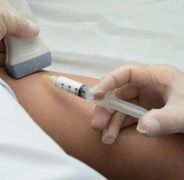 Sorriso: Mutir&atilde;o de exames para tratamento de varizes ser&aacute; realizado nessa ter&ccedil;a-feira (07/11) 