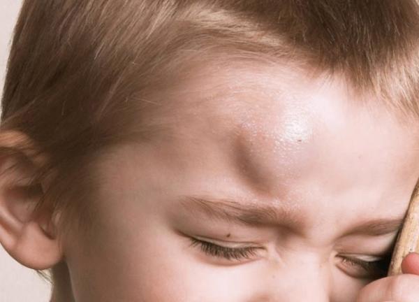 Sorriso: Beb&ecirc; cai da cama, fica sem ouvir e &eacute; levado para o Regional