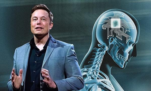 Empresa de Elon Musk realiza o 1&deg; implante de chip cerebral em um humano