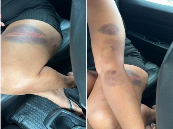 MT: Mulher &eacute; espancada pelo marido ap&oacute;s n&atilde;o fazer almo&ccedil;o 