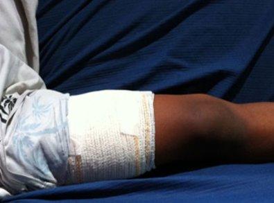 Bandido com passagens por furto, roubo e recepta&ccedil;&atilde;o, em Sorriso, leva tiro na perna como "puni&ccedil;&atilde;o" por comprar droga de fac&ccedil;&atilde;o rival