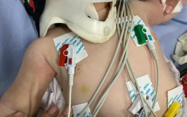 Médica chama a polícia após atender bebê com mais de 30 lesões no corpo, em Anápolis